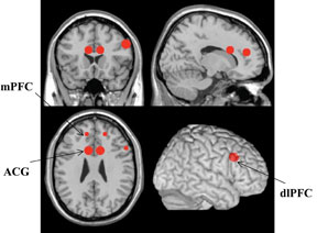 ipub.ca.cx, neuromarketing