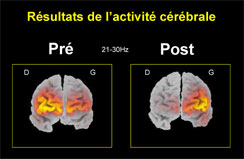 Affichage d'activit&eacute; c&eacute;r&eacute;brale
