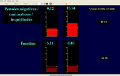 Diagramme d'activit&eacute; neuronale